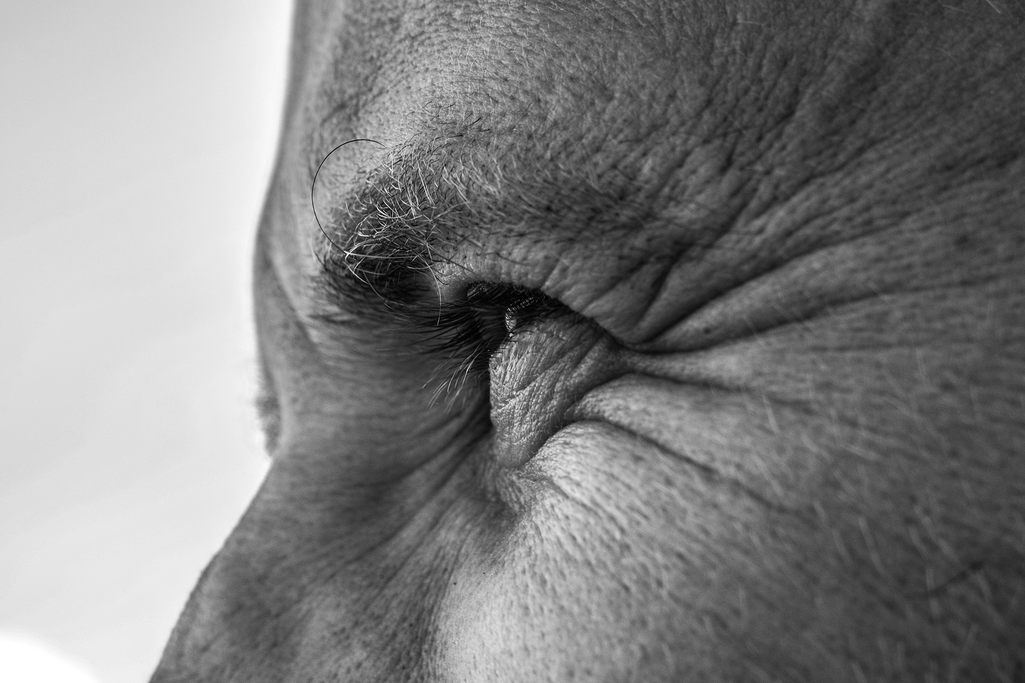 Zusammenhang von Alkoholkonsum, Hautalterung und Falten