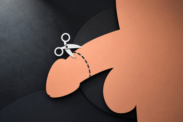 Symbolische Illustration einer Beschneidung im Erwachsenenalter mit stilisierter Darstellung und Scherensymbol.